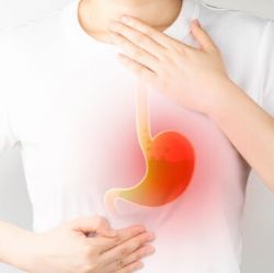 Acid Reflux (GERD)